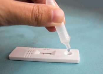 Farmácias da RaiaDrogasil já vendem autoteste de covid-19