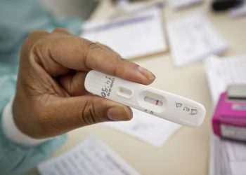 Anvisa aprova uso e comercialização de autotestes para covid-19